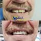 Slider image (9) Kool Dental